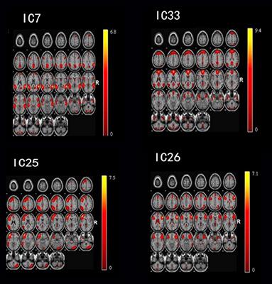 Abnormal Large-Scale Network Activation Present in Bipolar Mania and Bipolar Depression Under Resting State